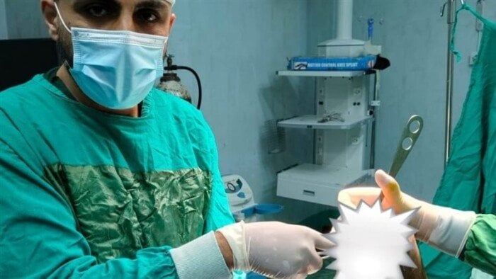 إنقاذ شاب يعاني من قرح وتآكل في مفصل الركبة بمستشفى قويسنا المركزي