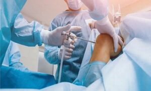 تقنية المنظار الجراحي.. كيف غيّرت مفهوم جراحات الركبة؟